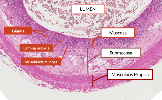Cells to Symptoms - Tired all the time